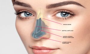 مزایای جراحی طبیعی بینی استخوانی چیست؟