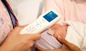 تشخیص زردی نوزاد با بیلی روبین چک