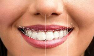 چطور یک لبخند زیبا داشته باشیم؟