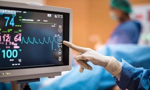دستگاه نوار قلب چگونه کار می کند؟