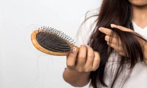 میزان طبیعی ریزش مو چه قدر است؟
